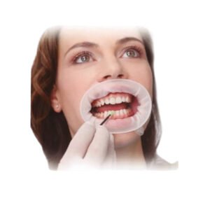 Abreboca Ivoclar Regular